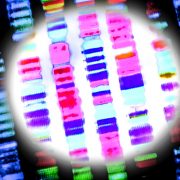 There’s New Proof Crispr Can Edit Genes Inside Human Bodies