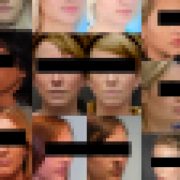 Artist finds private medical record photos in popular AI training data set