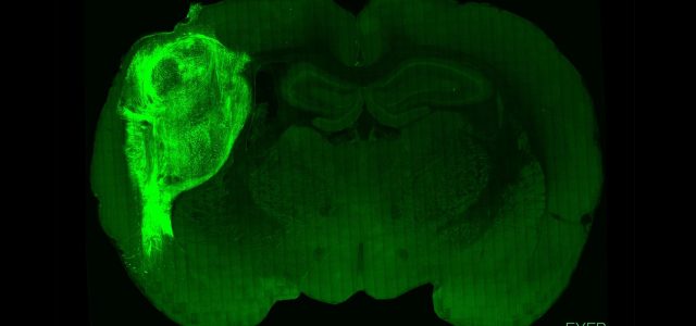 Lab-Grown Human Brain Tissue Works in Rats