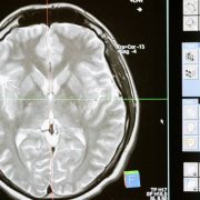 Why The Smart Money is Going into Thought Control