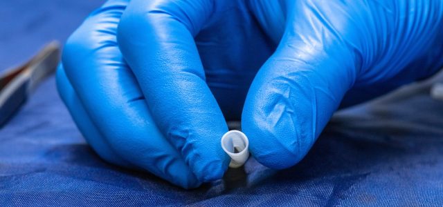 This Blood Vessel Was Grown in a Lab With Real Human Cells